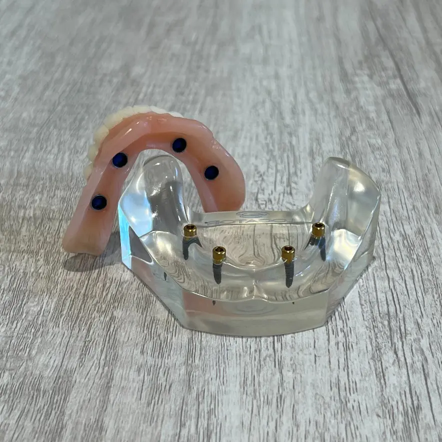 snap-in implant dentures Oakland, CA